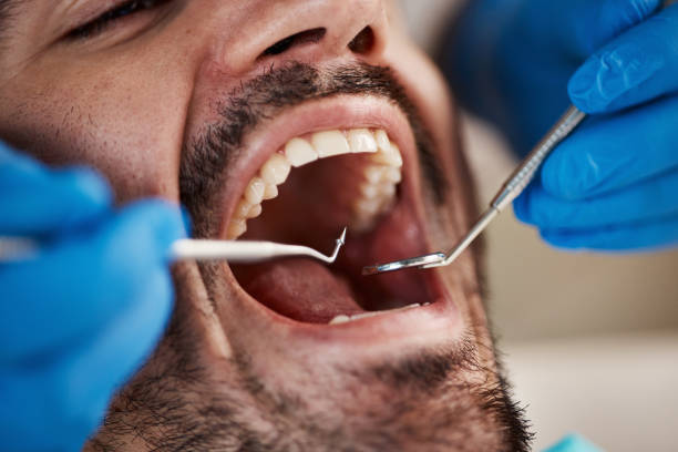 Best Broken or Chipped Tooth Repair in Landen, OH