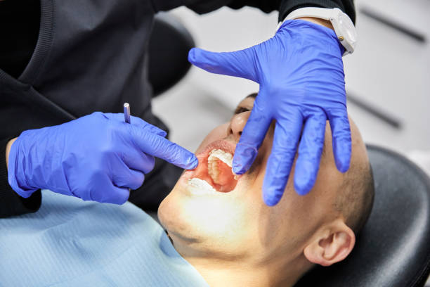 Best Emergency Dental Care for Sports Injuries in Landen, OH